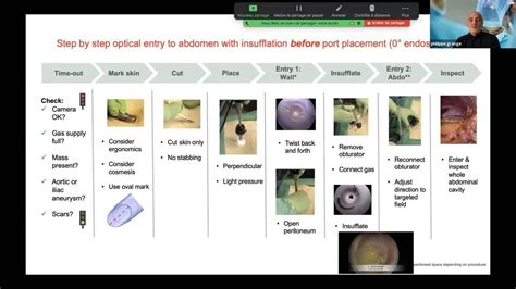 Lecture - "Primary Port Placement" by Prof. Philippe Grange | Johnson & Johnson Institute