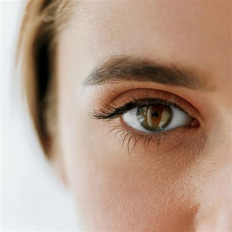 Eyelash Lice Causes & Symptoms - How to Get Rid of Eyelash Lice
