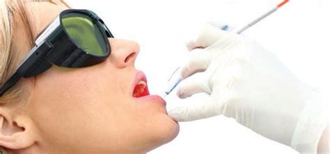 Laser Therapy In Periodontal Treatment