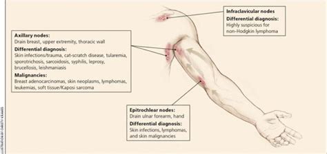 Lymphadenopathy in Pediatric Population — BROWN EMERGENCY MEDICINE BLOG