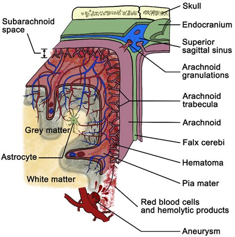 Fluid metabolic pathways after subarachnoid hemorrhage - Zhou - 2022 - Journal of Neurochemistry ...