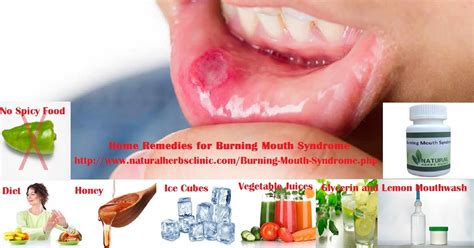 How Long Will the Burning Mouth Syndrome?: 6 Home Remedies for Burning Mouth Syndrome