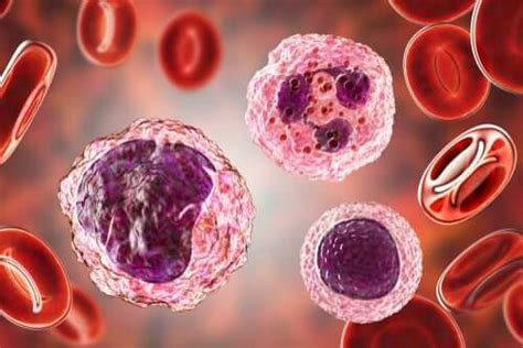 High Levels of Monocytes in the Blood: Symptoms and Treatments