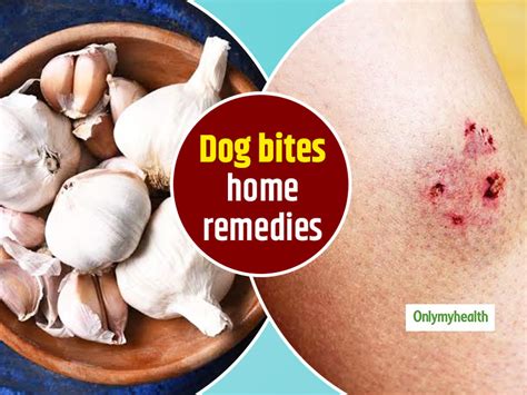 Should You Get A Tetanus Shot After A Dog Bite