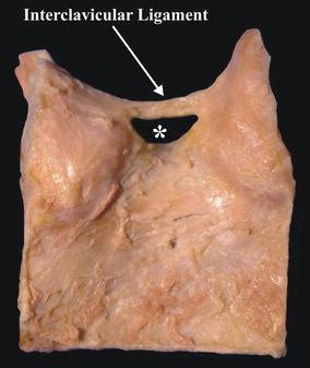 Surgical and clinical anatomy of the interclavicular ligament | SpringerLink