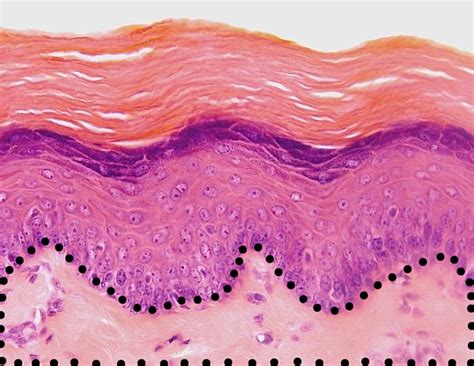 Stratified Squamous Keratinized Epithelium Labeled