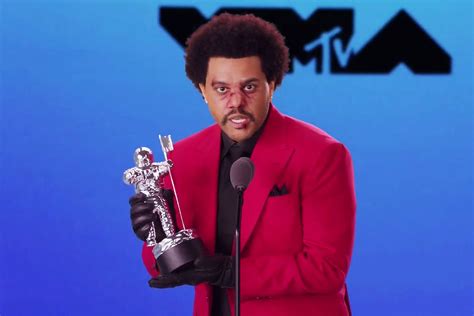 The Weeknd Debuts Plastic Surgery-Like Face in New Music Video