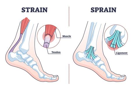 Tendons In The Foot