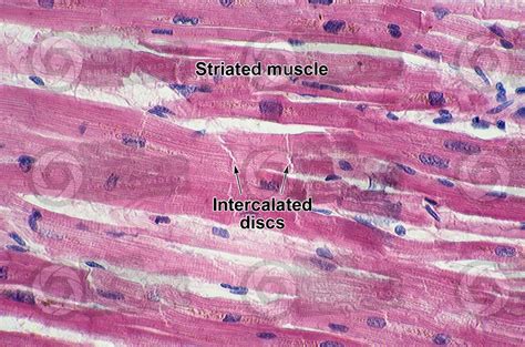 Man. Cardiac muscle. Longitudinal section. 500X - Man - Mammals - Circulatory system - Other ...