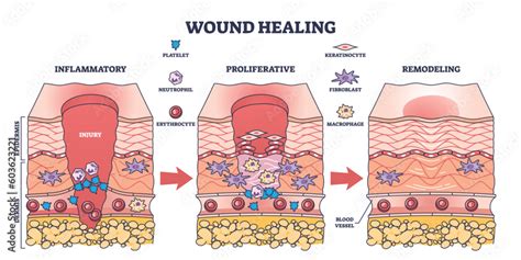 Process of wound healing and anatomical body injury repair outline ...