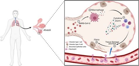 The immunology and immunotherapy for COVID-19 | Expert Reviews in Molecular Medicine | Cambridge ...