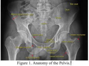 emDOCs.net – Emergency Medicine EducationPelvic fractures: ED ...