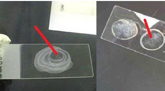 PREPARATION OF BACTERIAL SMEAR & HEAT FIXING - #1 Microbiology Resource Hub