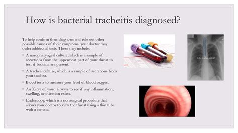 Tracheitis. The causes of tracheitis - online presentation