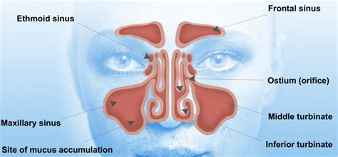 Pharmaceutics | Free Full-Text | Drug-Eluting Nasal Implants: Formulation, Characterization ...