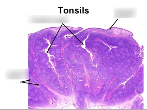 Lab 5 Histology of the Tonsils - slide feature Diagram | Quizlet