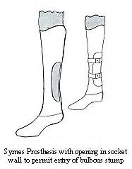 The Syme Prosthesis - A Manual for Below-Knee Amputees