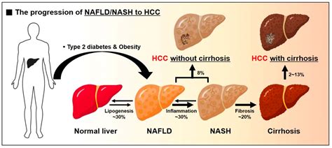 IJMS | Free Full-Text | Metabolic Spectrum of Liver Failure in Type 2 ...