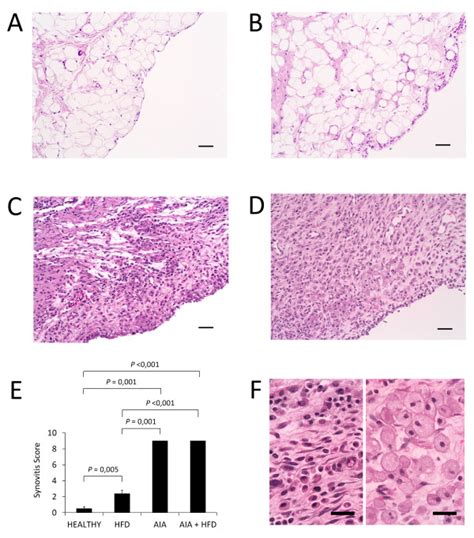 Histopathology of the synovial membrane. A-D, Representative sections... | Download Scientific ...