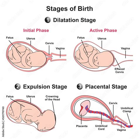 Stages of baby birth infographic diagram onset of labour flexion internal rotation of head ...