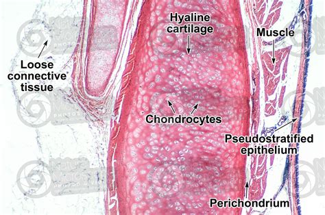 Mammal. Trachea. Transverse section. 64X - Hyaline cartilage - Cartilage - Animal histology - Photos