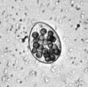 Tetrahymena thermophila - microbewiki