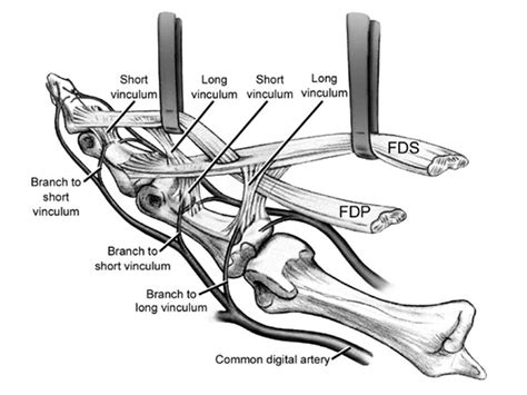 Biology and anatomy of flexor tendon - YouTube