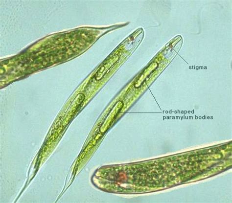 "Medical significance of euglena" >> "linnaean classification euglena" | "example euglena"