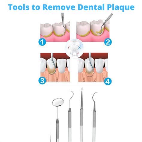 Dental Tool Kit | Dental tools, Dental, Plaque removal