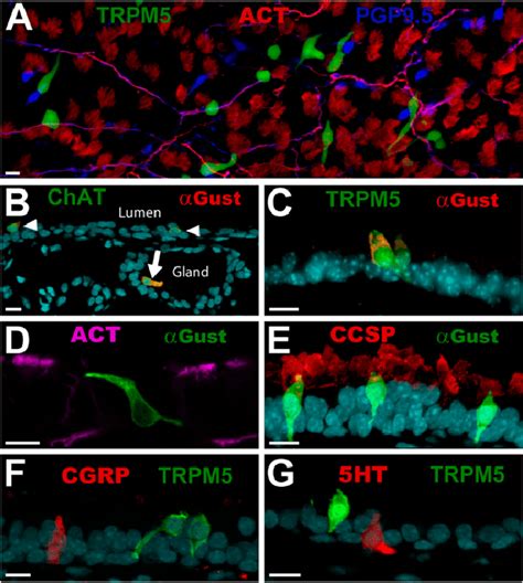 Brush cells (BCs) comprise a distinct cell type in the tracheal ...