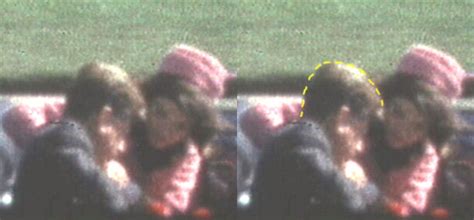 The Zapruder Film and President Kennedy: Where was the Head wound?