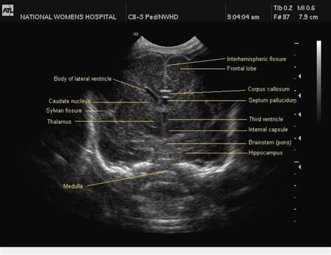 1131 best ultrasound notes images on Pinterest | Notes, Ultrasound and Medical