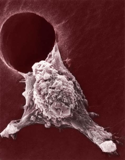 Metastasis Of A Cancerous Cell Photograph by Science Photo Library - Pixels