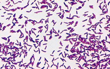 Corynebacterium Gram Stain