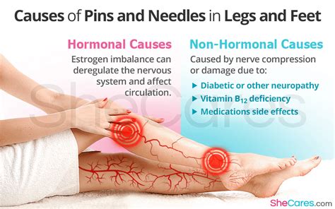 How To Avoid Pins And Needles - Issuebehalf9