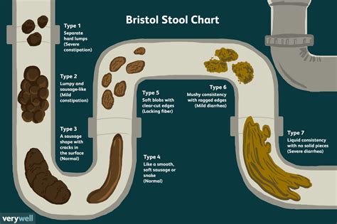 Un aperçu du graphique des selles de Bristol