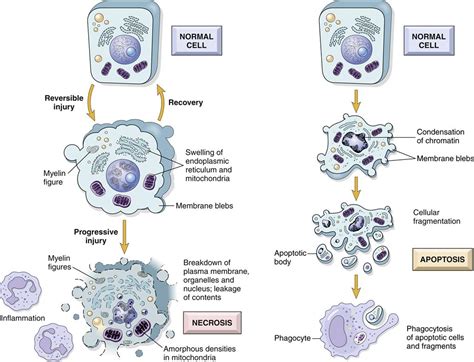 Cell Injury, Aging, and Death | Basicmedical Key