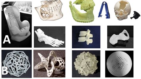 3D Printing and its Future in Medical World | Journal of Medical ...