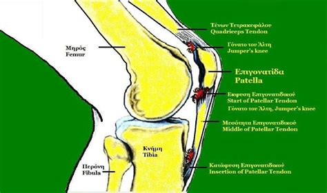 FUNK ROBERTS FITNESS BLOG: LEG EXERCISES TO HELP COMBAT JUMPERS KNEE - FIGHTERS KNEE - RUNNERS KNEE