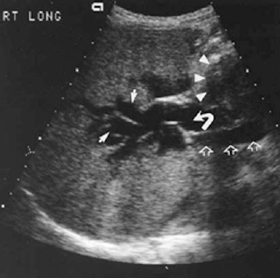 The Biliary Tree and Pancreas | Radiology Key