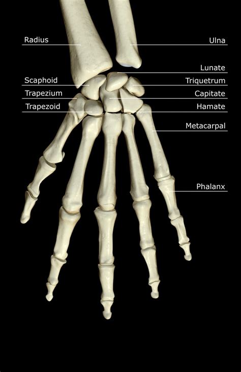 Fractures in the Hook of Hamate Bone in Wrist