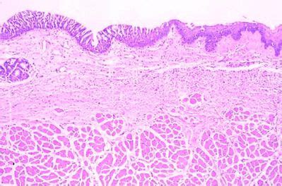 Larynx Histology Slide