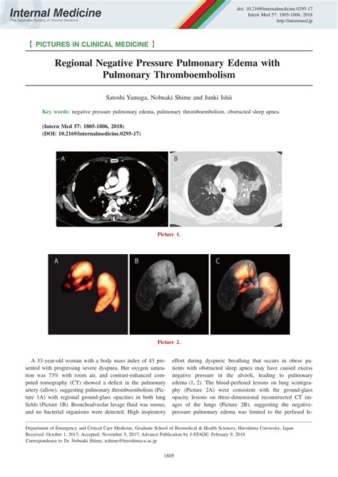 (PDF) Regional Negative Pressure Pulmonary Edema with Pulmonary ...