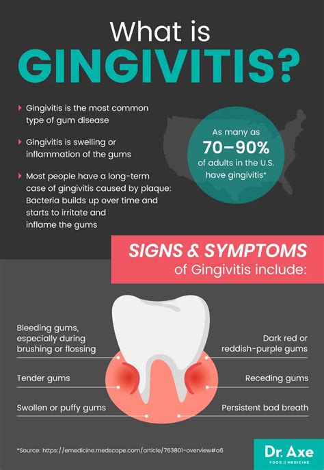 What Is Gingivitis Symptoms Causes And Treatments Cre - vrogue.co