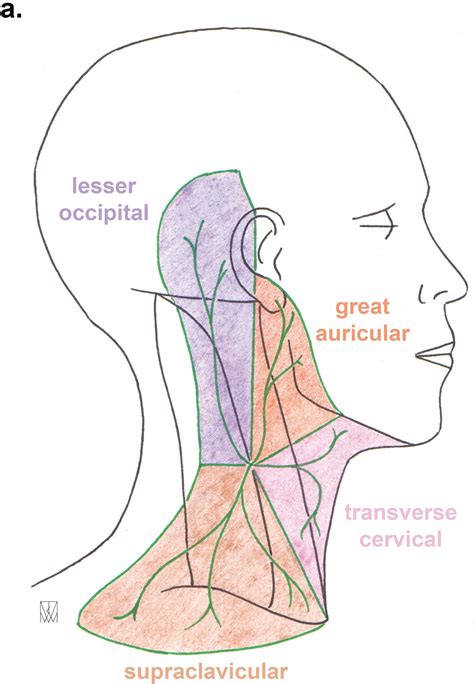 Lírico yeso Supresión cervical plexus block Por separado preocupación ...