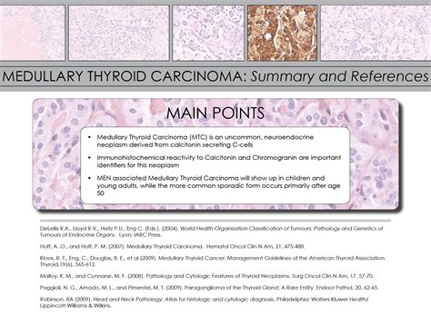 Medullary Thyroid Carcinoma Pathology | Iowa Head and Neck Protocols