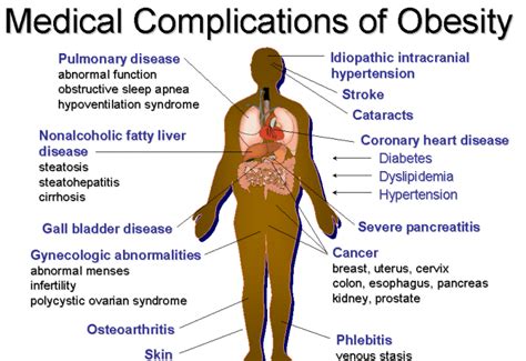 Exogenous Obesity Vs Morbid Obesity