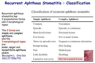 Recurrent aphthous stomatitis | PPT