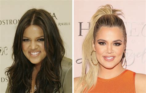 Khloé Kardashian Reveals She’s Only Gotten One Nose Job • Hollywood ...