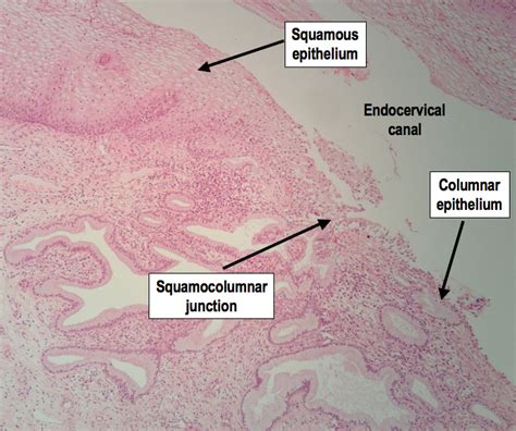 HistoQuarterly: CERVIX | Histology Blog